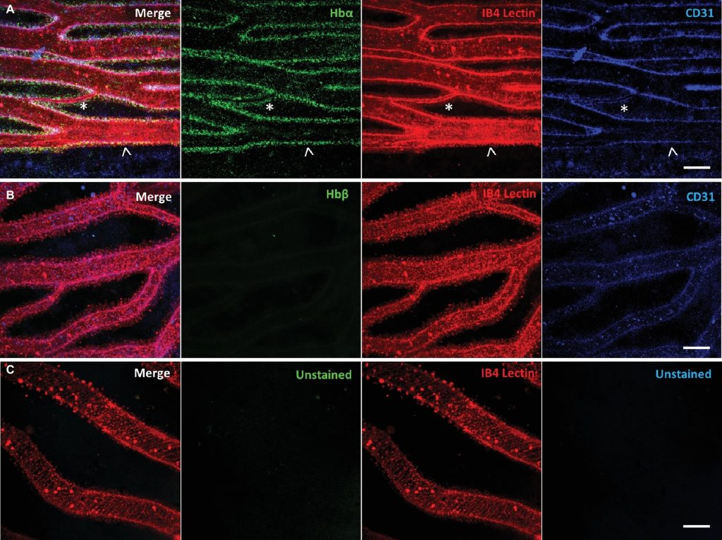 Galerie de 16 images au microscope. Chaque rangée est composée de 4 images du même réseau de vaisseaux sanguins, avec différents marquages. Rangée A : la première image représente la superposition des 3 marquages; la deuxième image montre le marquage de Hbα à la surface des vaisseaux sanguins; la troisième image montre le marquage par la lectine à la surface des vaisseaux sanguins; la quatrième image montre le marquage de CD31 à la surface des vaisseaux sanguins. Rangée B : la première image représente la superposition des 3 marquages; la deuxième image montre que rien n’a été marqué par anti-Hbβ; la troisième image montre le marquage par la lectine; la quatrième image montre le marquage de CD31. Rangée C : Le seul marquage apparent est celui par la lectine. Cette rangée agit comme un témoin.